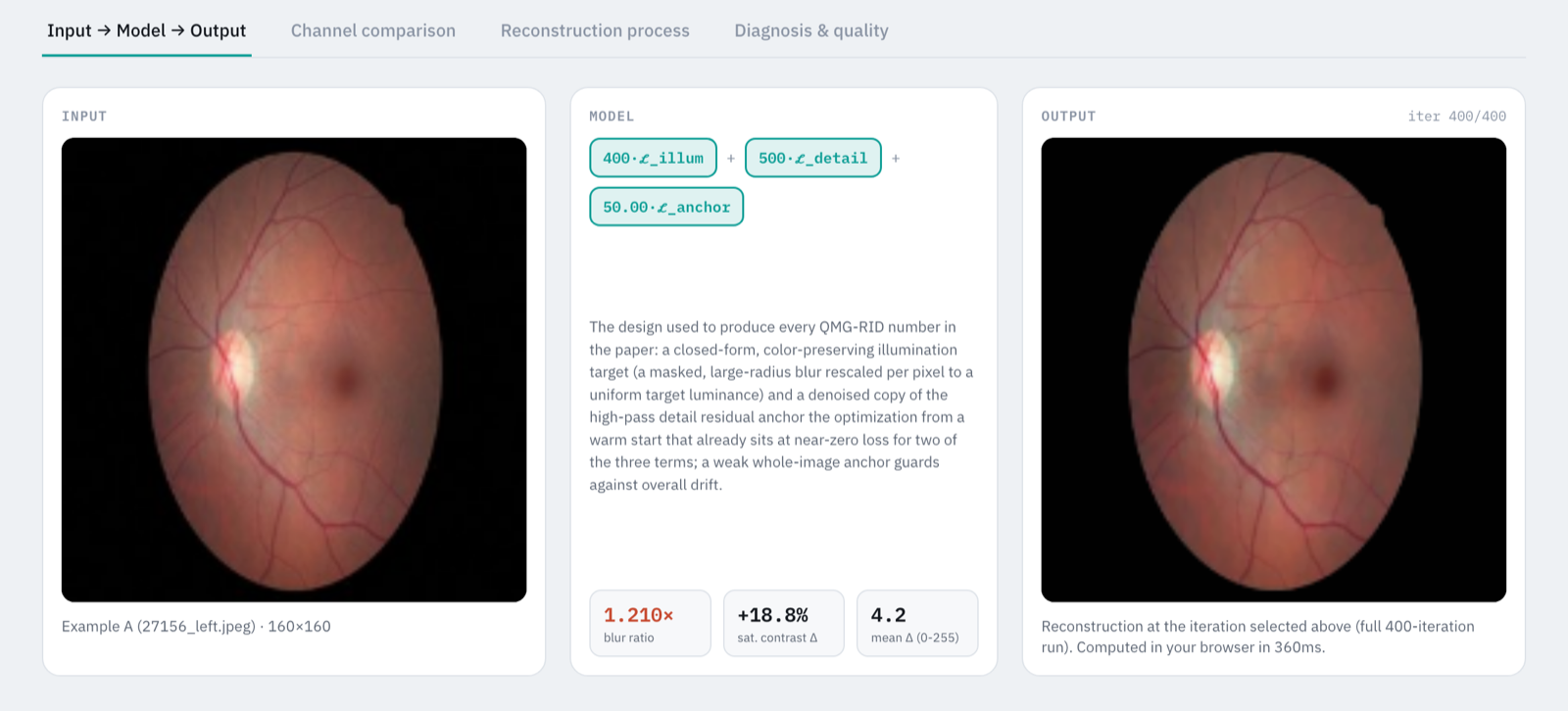 QMG-RID Explorer — Fundus Image Enhancement — research pipeline
